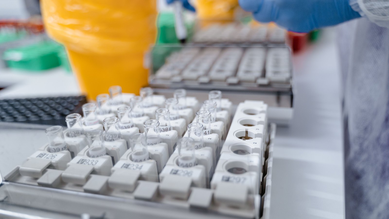 Close-up of a laboratory bench where racks of small clear sample tubes sit in white numbered holders, with a gloved hand reaching in from the top of the frame and a yellow waste bin blurred behind. Only rack position numbers are legible; no names, logos or faces are visible. Illustrative only, not a photograph of this event.